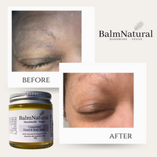 Load image into Gallery viewer, Before and after, unscented skincare balm, hydrates face and locks in moisture
